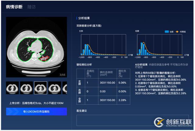 百度「AI戰(zhàn)疫」：首次開(kāi)源肺炎CT影像分析模型，讓診斷從分鐘到秒